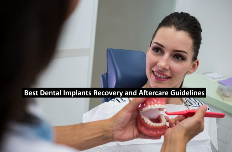 Best Dental Implants: Recovery and Aftercare Guidelines